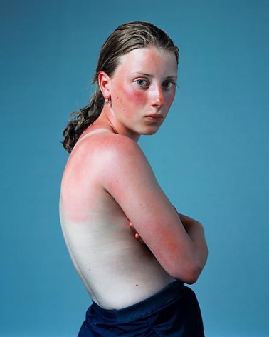  Sunburnt, June 2001