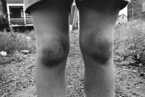 Dark Knees. WIlkes-Barre. December, 1974.